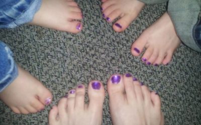 Toes Painted Purple for Epilepsy Awareness Month 2013