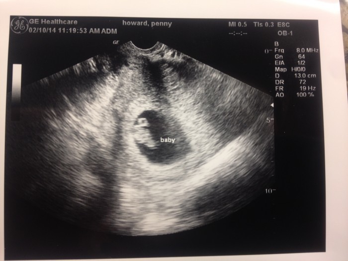 Baby Howard, 8 weeks. Due September 2014